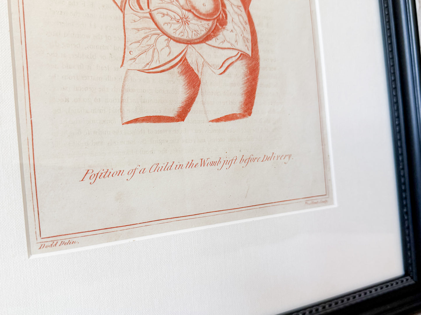 Antique Fetal Anatomy Engraving from Culpeper's English Physician, c1800 - "Position of the Child in the Womb Just Before Delivery" in Custom Frame