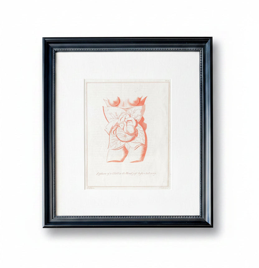 Antique Fetal Anatomy Engraving from Culpeper's English Physician, c1800 - "Position of the Child in the Womb Just Before Delivery" in Custom Frame